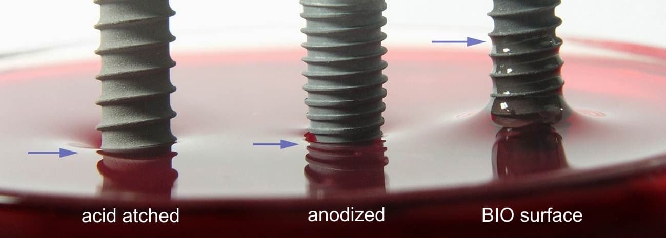 Comparaison de la mouillabilité des implants en titane à surface mordancée, anodisée et BIO