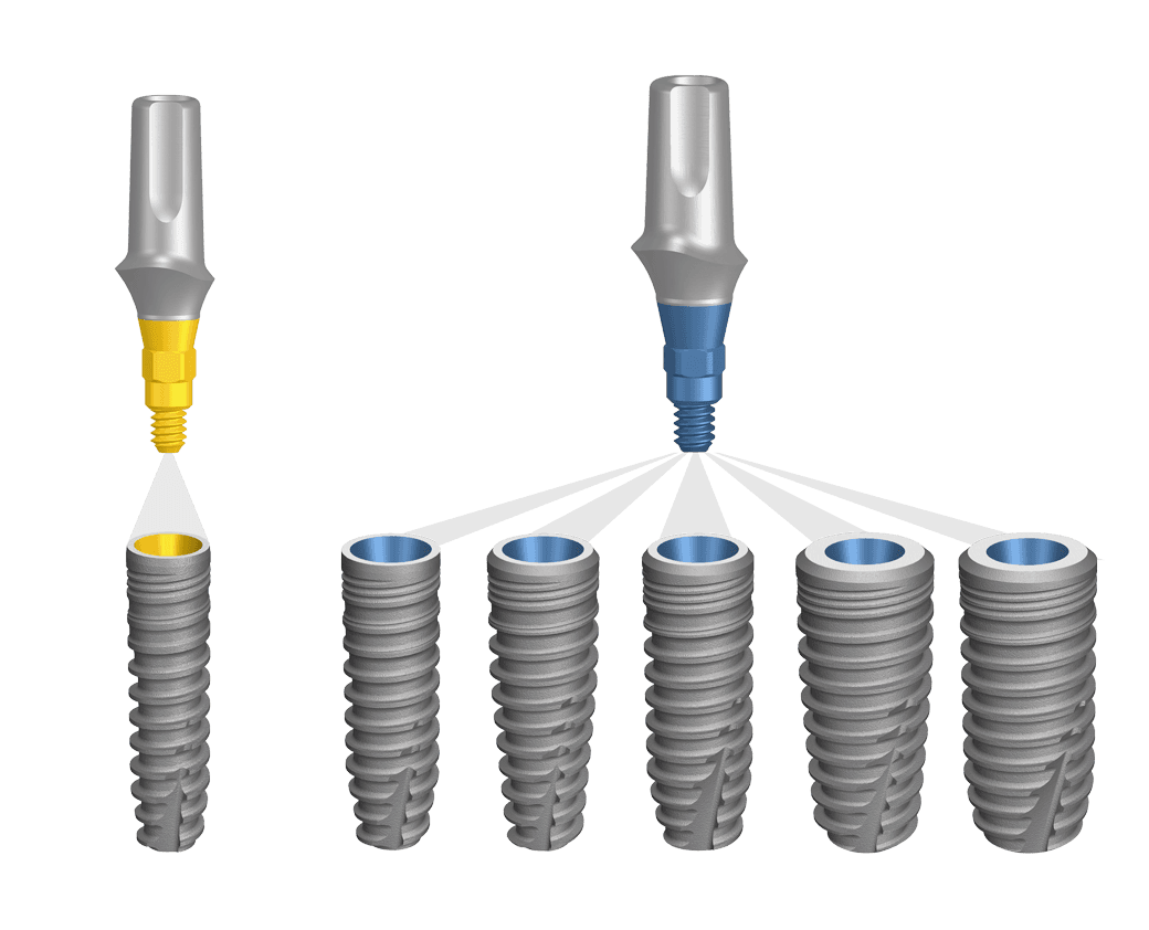 Composants prothétiques BioniQ pour des restaurations personnalisées