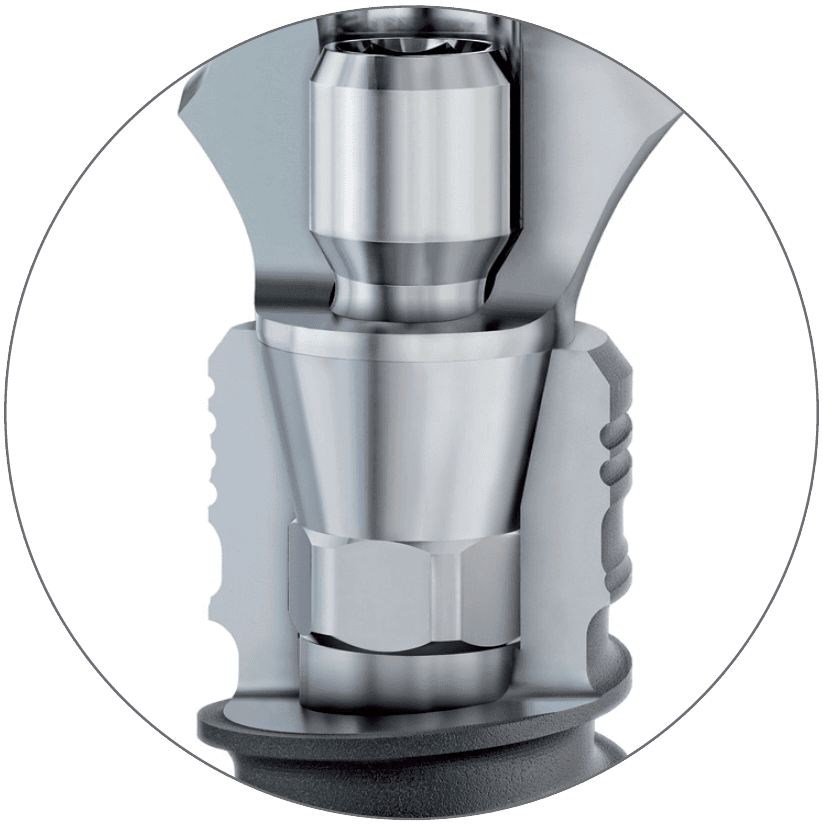 Coupe transversale de la connexion implant-pilier Q-Lock de BioniQ
